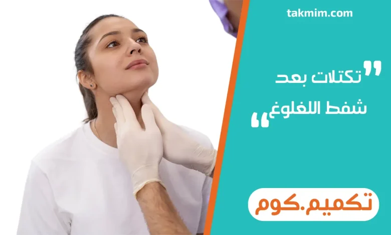 تكتلات بعد شفط اللغلوغ
