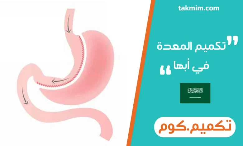 تكميم المعدة في أبها