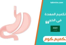 تكميم المعدة في الخبر