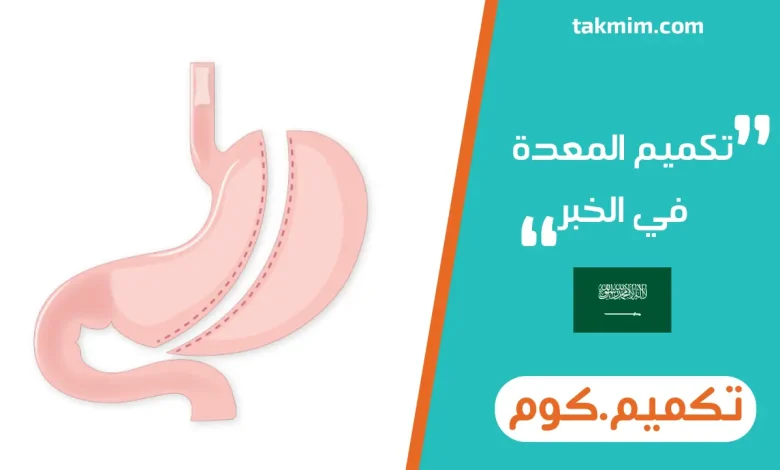 تكميم المعدة في الخبر