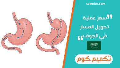 سعر عملية تحويل المسار في الجوف