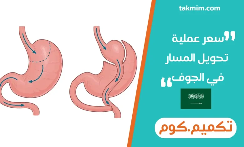 سعر عملية تحويل المسار في الجوف