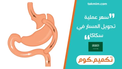 سعر عملية تحويل المسار في سكاكا