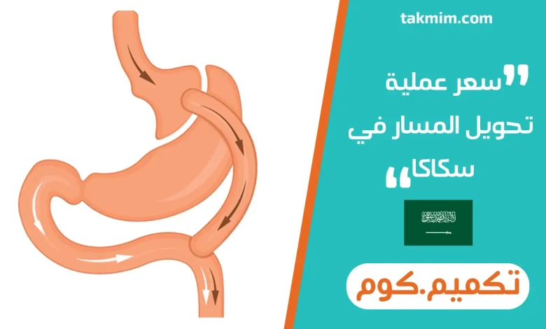 سعر عملية تحويل المسار في سكاكا