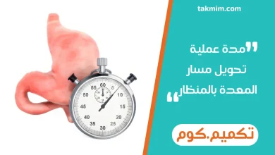مدة عملية تحويل مسار المعدة بالمنظار