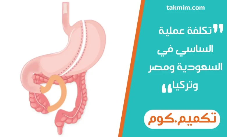 تكلفة عملية الساسي في السعودية ومصر وتركيا