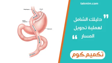 دليلك الشامل لعملية تحويل المسار