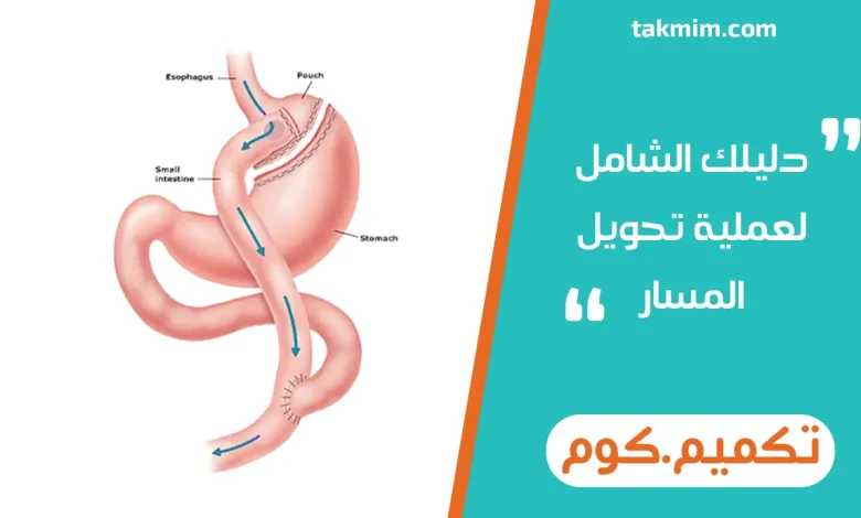 دليلك الشامل لعملية تحويل المسار