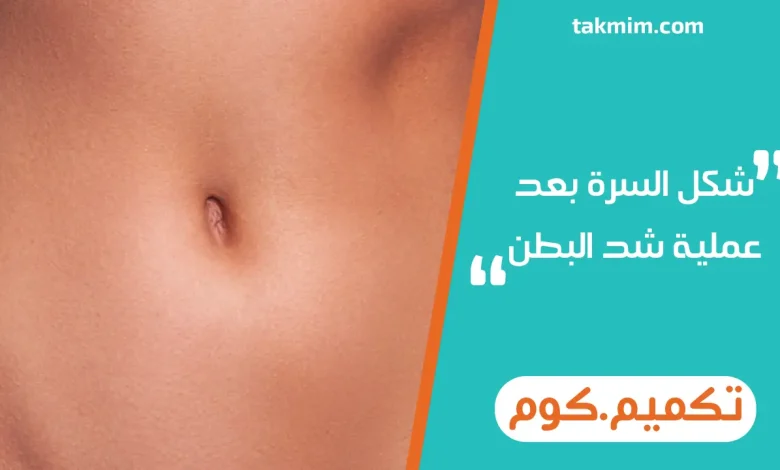 شكل السرة بعد عملية شد البطن