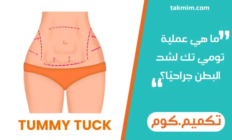 ما هي عملية تومي تك لشد البطن جراحيًا؟